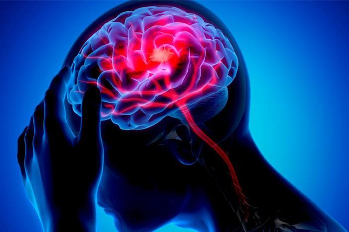 دراسة توضح علاقة ضغط الدم والسكري بالسكتة الدماغية