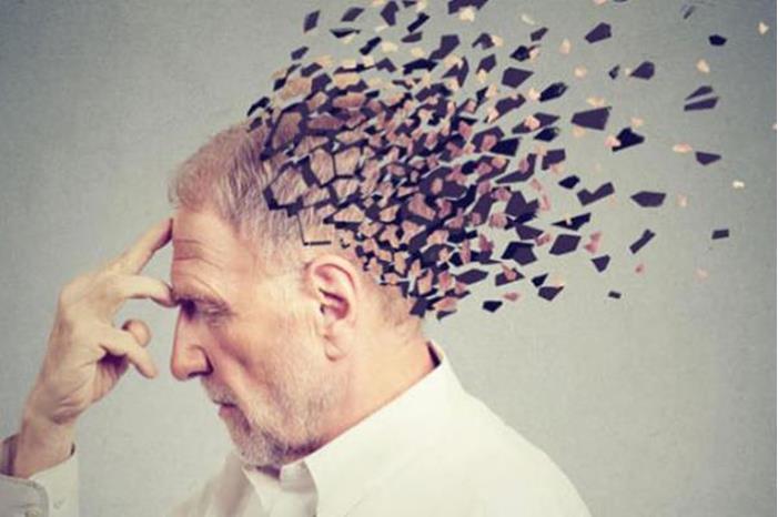 دراسة تكشف عن علاج محتمل للزهايمر