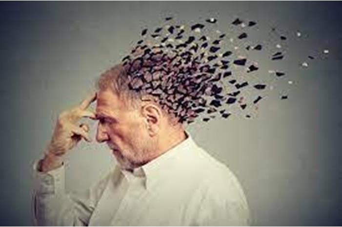ابتكار مركب غير سام لمكافحة الزهايمر