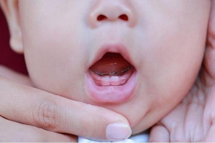 تسنين الأطفال.. أعراض تستدعي استشارة الطبيب