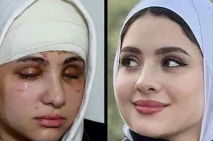 بعدما فقدت بصرها.. البلوغر المصرية سارة محمد تعلن خطوبتها