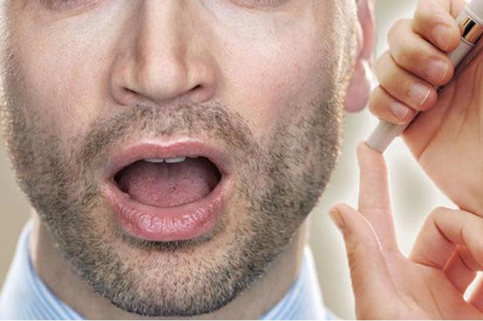 إنذار بمرض السكري.. 6 علامات في الفم