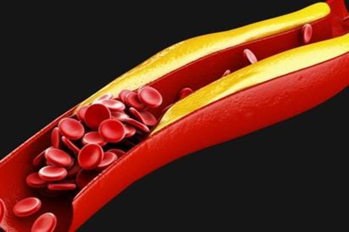 تناول ثمرة واحدة من هذه الفاكهة يعمل على خفض الكولسترول بالدم