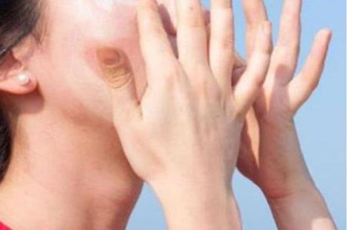لحماية بشرتك من شمس الصيف .. 3 مشروبات تناولها يوميًا