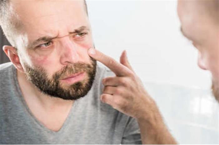 أشياء تظهر في العين تخبرك عن صحتك