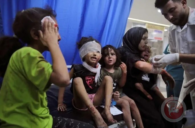 أزمة إنسانية في غزة: 10 أطفال يفقدون أطرافهم يومياً
