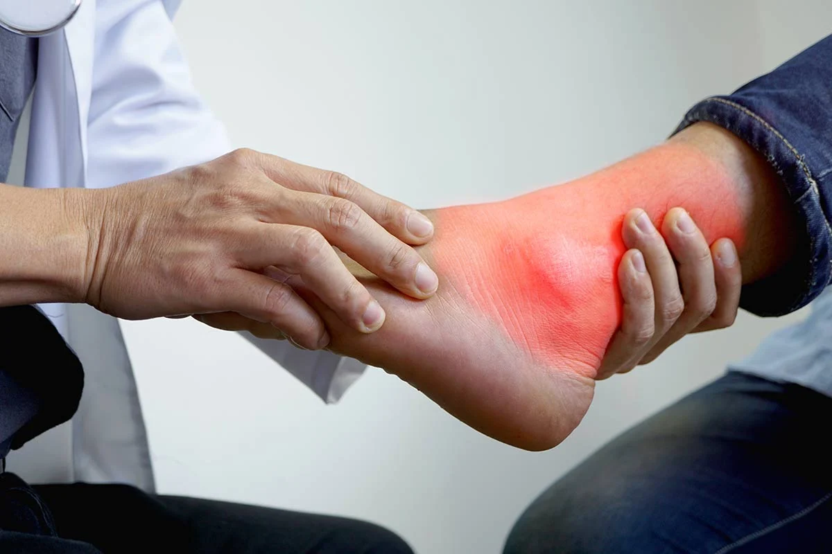 كيف تؤثر زيادة الأملاح في القدم على صحتك ؟