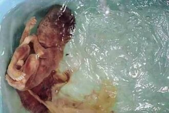شوربة الأجنة المجهضة في الصين وصفة جديدة للصحة والجمال