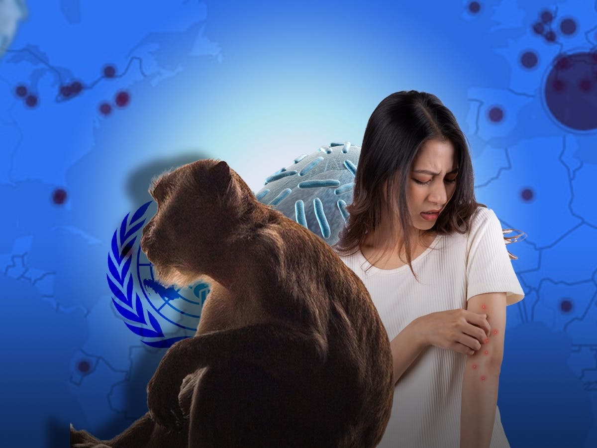 عاجل | دور الحكومات والمنظمات الصحيّة في التصدي لفيروس جدري القرود
