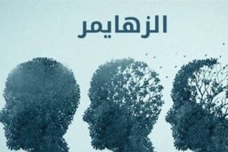 ماهي العادات التي تزيد خطر الإصابة بالزهايمر ؟