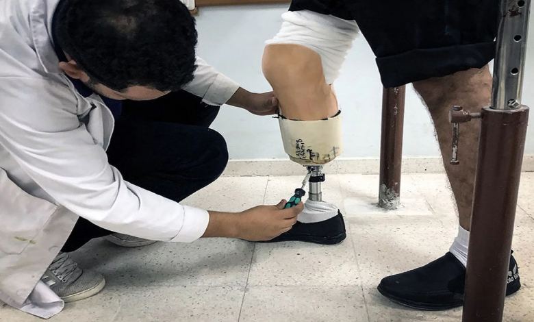 بمبادرة أردنية تركيب 30 طرفاً صناعياً في قطاع غزة