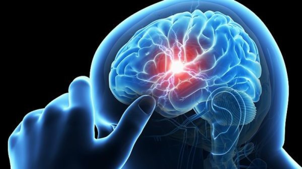 عوامل للتقليل من خطر الإصابة بالسكتة الدماغية