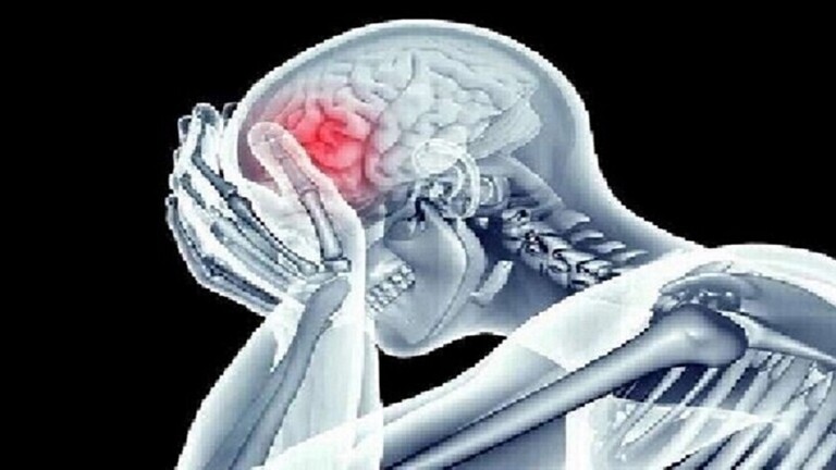 طبيب: الجلطة الدماغية قد تبدأ قبل سنوات من ظهور العلامات المرئية الأولى