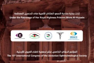 المؤتمر الدولي الخامس عشر لجمعية أطباء العيون ينطلق غداً