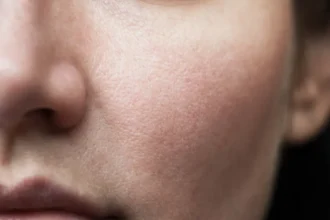 كيف تتجنبين ظهور المسام الكبيرة؟