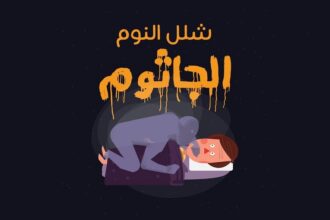 ماذا تعرف عن الجاثوم ؟