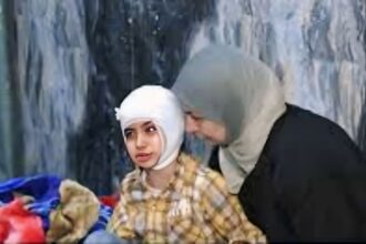 كابل كهربائي يسقط على طفل ويقلب حياته رأساً على عقب في بغداد