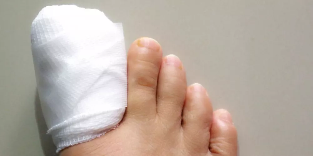 ما بعد استئصال الظفر: تعليمات طبية مهمة لتسريع الشفاء وتجنب المضاعفات