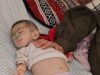 وفاة الطفلة جنان الكافي بسبب سوء التغذية وتفشي المجاعة في غزة