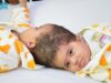 نجاح فصل التوأم الإريتري "أسماء وسمية" في عملية استغرقت 15 ساعة