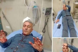 ملثمون يعتدون بالهراوات على الصحفي فارس الحباشنة