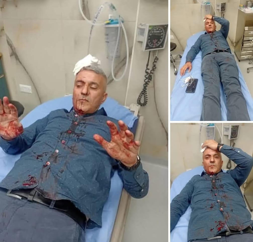 ملثمون يعتدون بالهراوات على الصحفي فارس الحباشنة