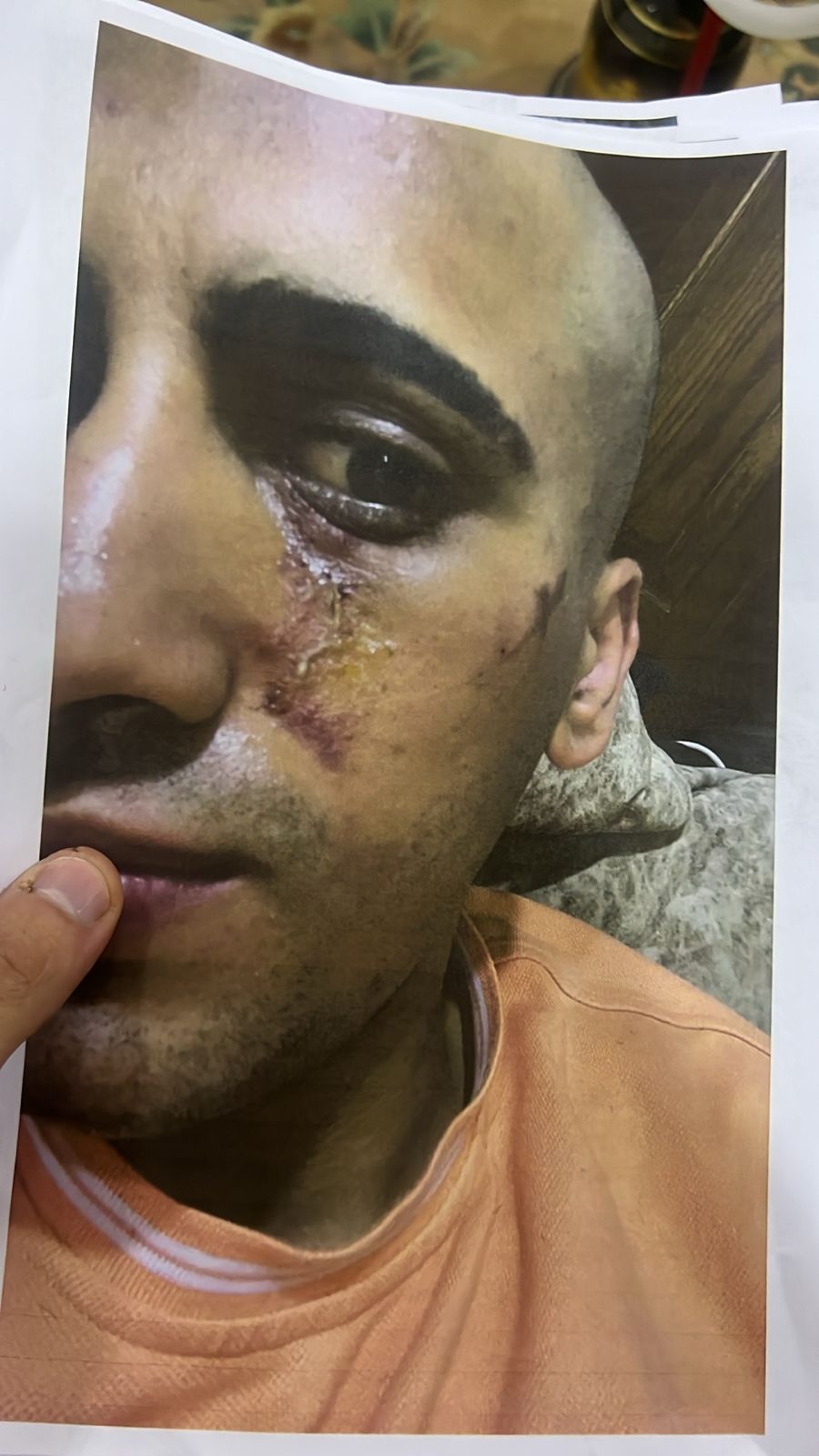 عاجل | أحمد يخرج عن صمته ويكشف تفاصيل تعذيبه هو وشقيقته على يد والده وإخوته .. فيديو وصور