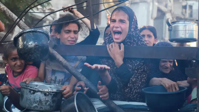 وزارة الصحة بغزة: 300 ضحية جراء المجاعة وسوء التغذية
