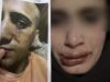 عاجل | أحمد يخرج عن صمته ويكشف تفاصيل تعذيبه هو وشقيقته على يد والده وإخوته .. فيديو وصور