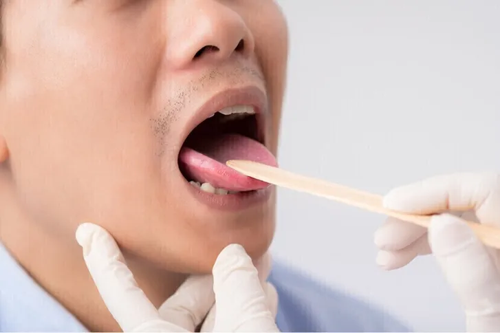 أعراض مبكرة لسرطان الفم لا يجب تجاهلها