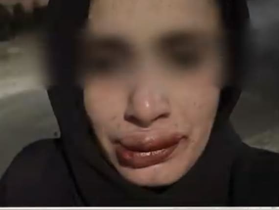 عاجل | أحمد يخرج عن صمته ويكشف تفاصيل تعذيبه هو وشقيقته على يد والده وإخوته .. فيديو وصور
