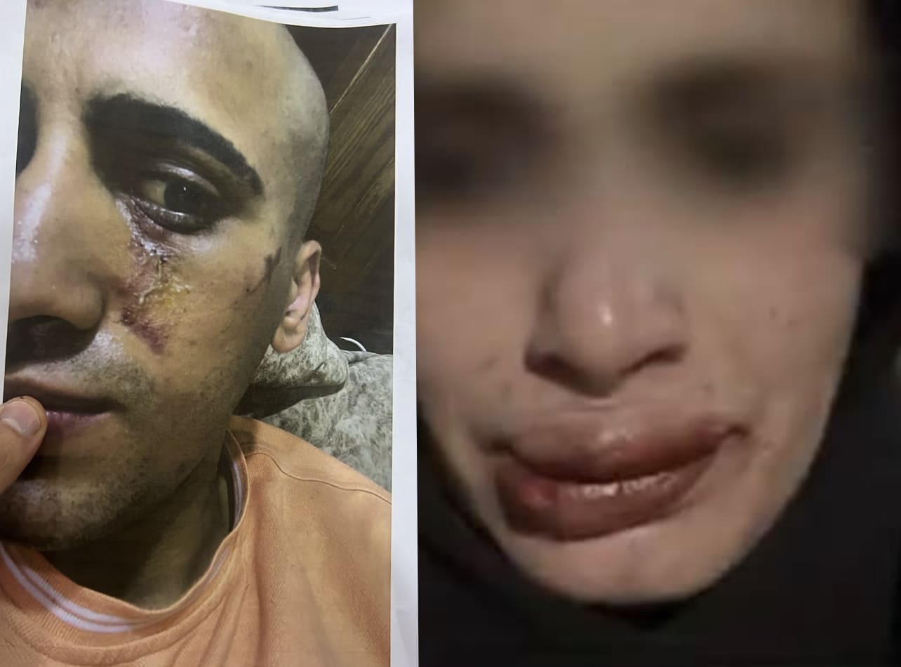 عاجل | شقيقة احمد تخرج عن صمتها "ما فشر يكون أب إلي.. خلاني مريضة نفسيًا" .. فيديو