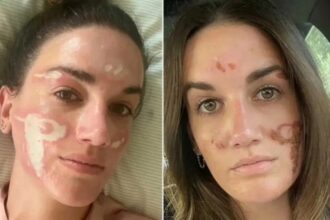 خبيرة تجميل تشوه وجه فتاة وتكلفها 90 ألف دولار
