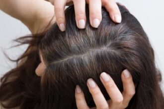 ممثلة صينية تثير الجدل بعلاج “حقن يعيد الشعر الأبيض إلى الأسود”