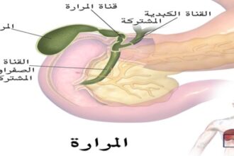 ركود الصفراء لأكثر من 3 أسابيع يسبب تغيرات لا رجعة فيها في الكبد