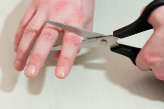بعد رفض الاستقالة .. رجل في الهند يقطع أربعة أصابع لنفسه