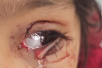 صورة حول : المحامي العجوري يسأل عن سلطة جمعية الرفق في الحيوان المحامي العجوري يسأل عن سلطة جمعية الرفق في الحيوان