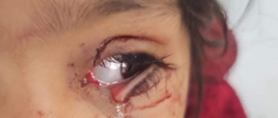 صورة حول : المحامي العجوري يسأل عن سلطة جمعية الرفق في الحيوان المحامي العجوري يسأل عن سلطة جمعية الرفق في الحيوان